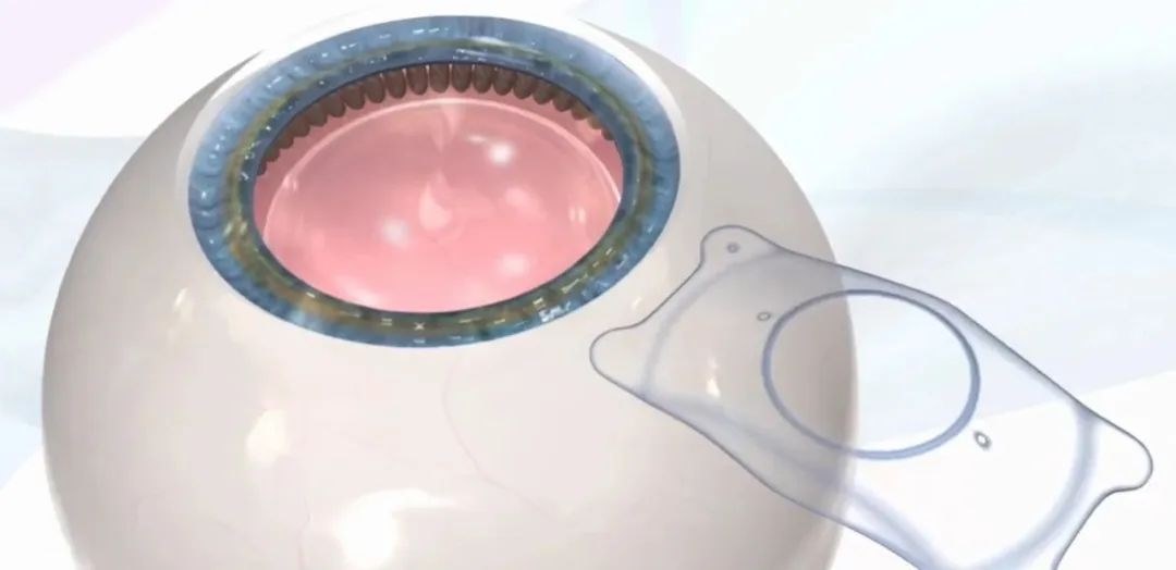 圖片.png 圖片.png