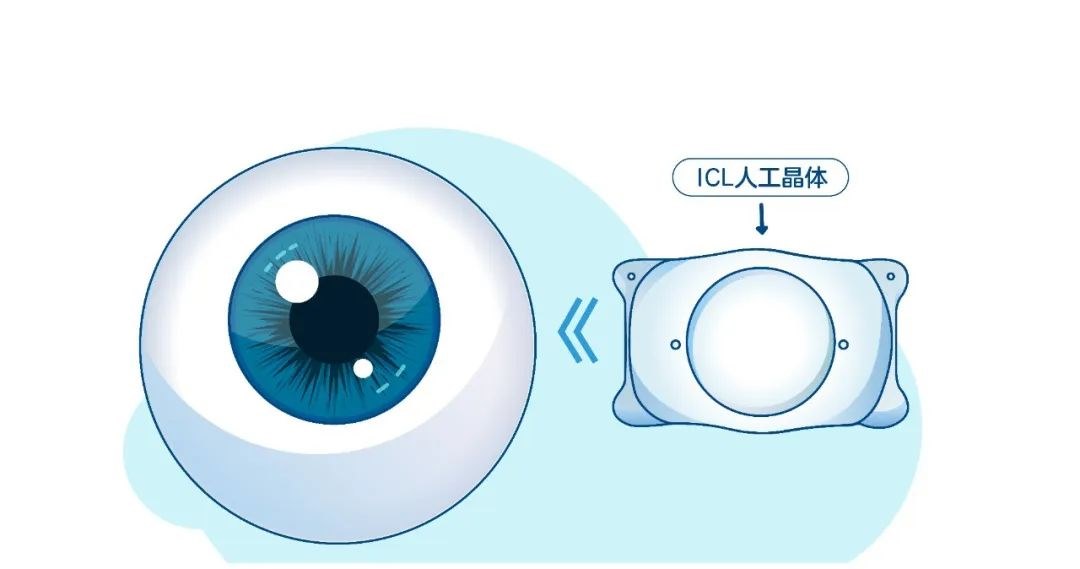 圖片.png 圖片.png