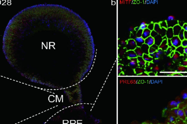 Standard Post with Image